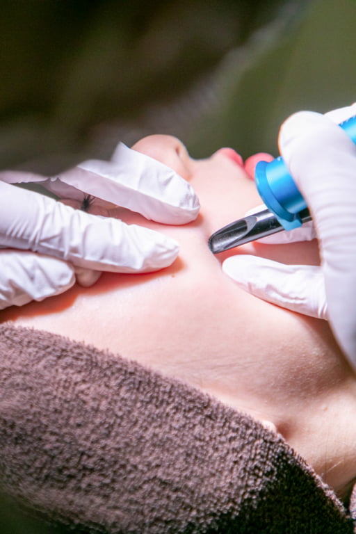 施術中の写真 肌に器具を当てている